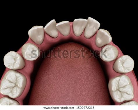 human teeth position   images shutterstock
