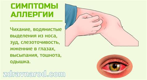 Аллергия | Народная медицина
