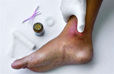 Wound Care - medi USA