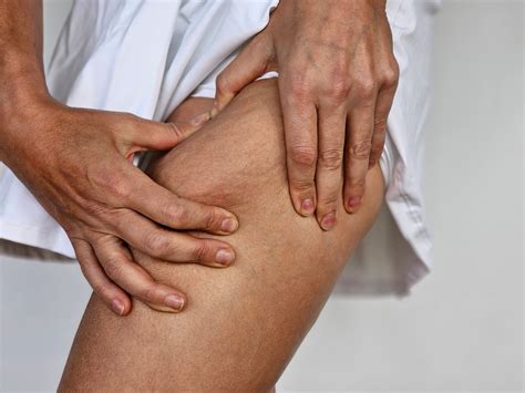 Why Is Only My Left Leg Swelling? Main Causes + What to Do - Cancer