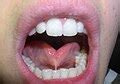 categorytongue examination wikimedia commons