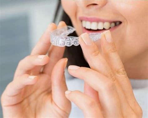 A Patient's Guide to Basic Invisalign Care - Recentdrone