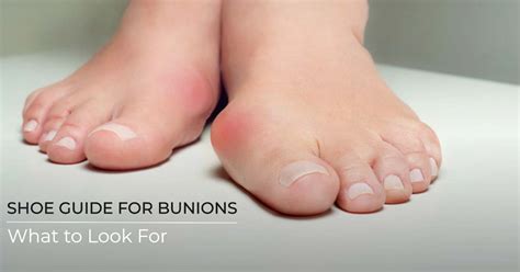 The Ultimate Shoe Guide For Bunions