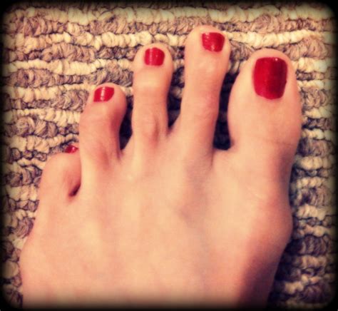 Long Ugly Toenails