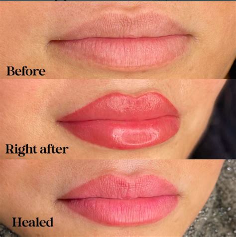 Souirensu It Works: My Before & After Photos Will SHOCK You! - i094ujm