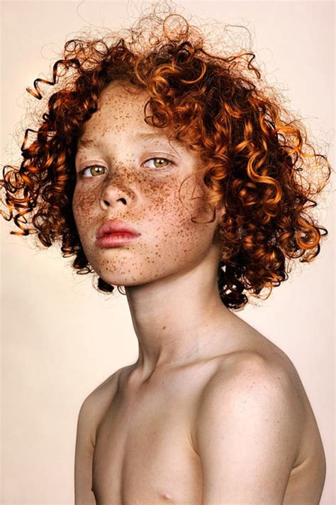 freckles photographer shines spotlight   beauty  spots