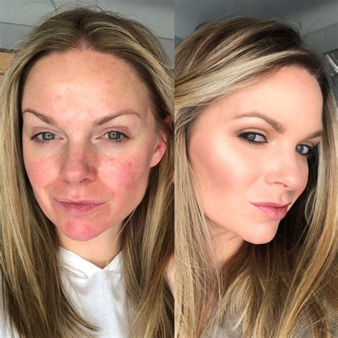 Bye Bye Redness: the products I use to correct redness on my face
