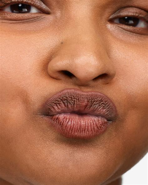 blackheads on lip line 6