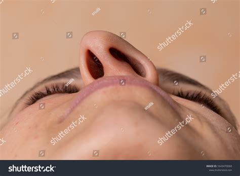 58 Deviated Nasal Septum Surgery Images, Stock Photos & Vectors | Shutterstock