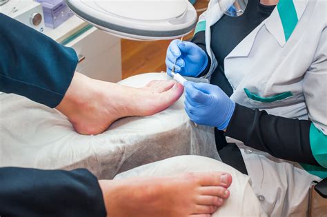 Should You Get Fake Toenails For Fungus? Learn The Truth! – DNF