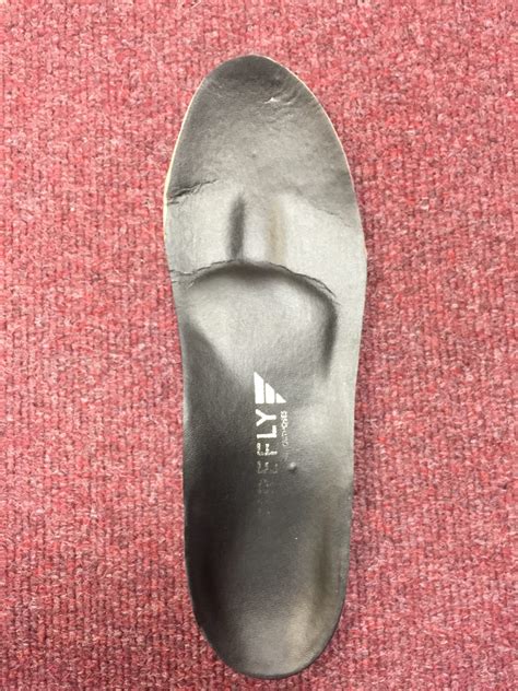 Plantar plate tear | Podiatrist in Edinburgh and Perth