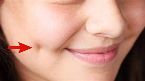How To Get Dimples Fast And Naturally/ Beauty Tips - YouTube
