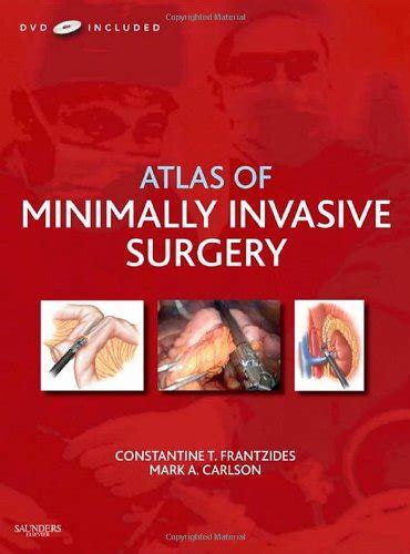 Atlas of Minimally Invasive Surgery with DVD - Constantine T ...