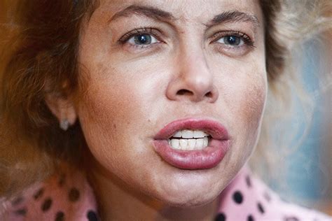 Создать мем "божена рынска до пластики, божена рынска страшная, божена ...