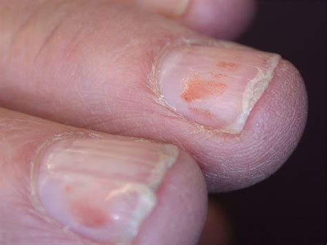 The Art Of Repair: 5+ Ways To Mend A Split Nail