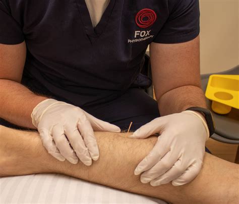 Dry needling - Fox Physiotherapy