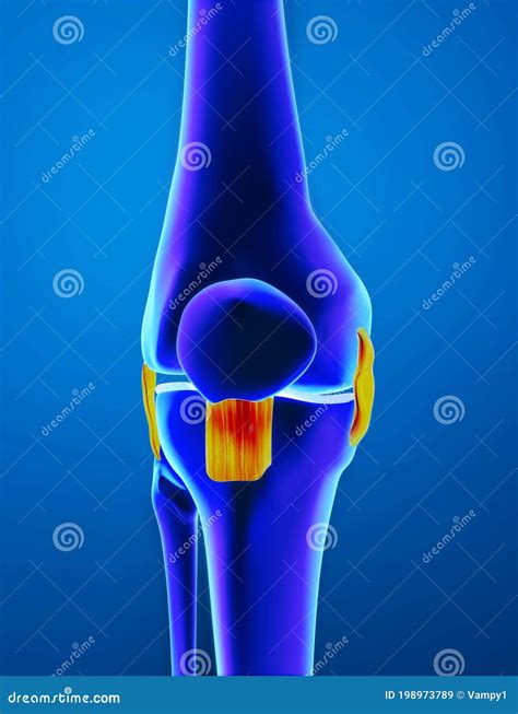 Inflammation, Sprained Knee Ligaments. Femur, Buckle and Patella Seen