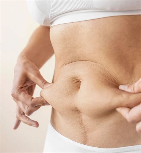 how to get rid of loose abdominal skin