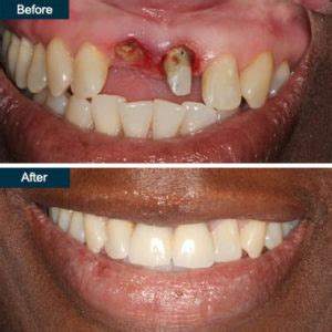 top rated family cosmetic dentist  yonkers ny