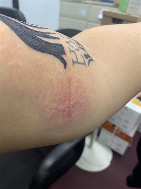 Is this bruising or a bad sign? : r/tattooadvice