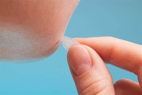Do pimple patches work? Dermatologists shared pros and cons - The Manual