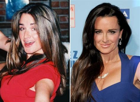 Kyle Richards | Kyle richards plastic surgery, Plastic surgery, Kyle ...