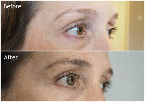 My RapidLash And RapidBrow Experience: Before And After | Melissa Jane Lee