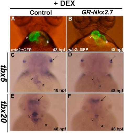 Each embryo derived from transgenic line Tg(cmlc2::GFP), whose heart ...