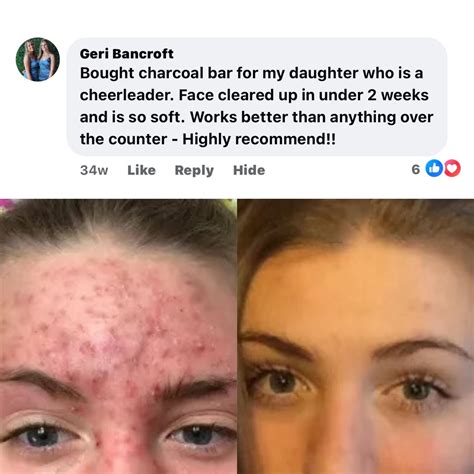 Ballgirlz Face Scrub 3 Pack – BALLBOYZ