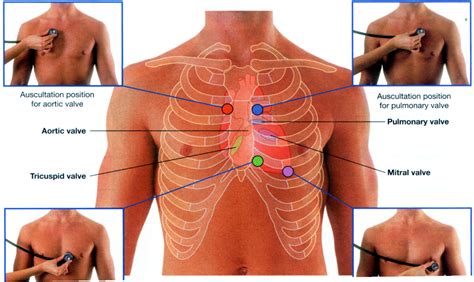 Heart sounds, by location Diagram | Quizlet