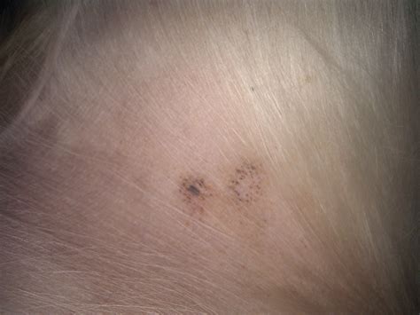 What Are Black Spots On A Dog S Belly at Brooke Donald blog