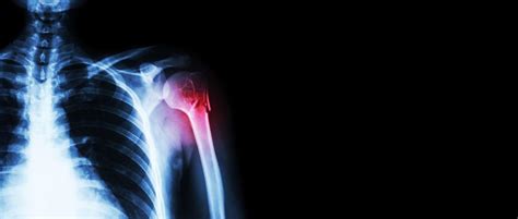 orliman atorlimanop twitter