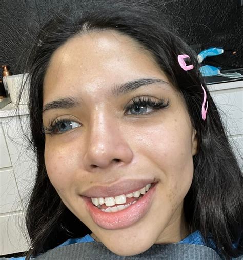 Así lucía Yeri Mua antes de sus cirugías estéticas - GoBizNext