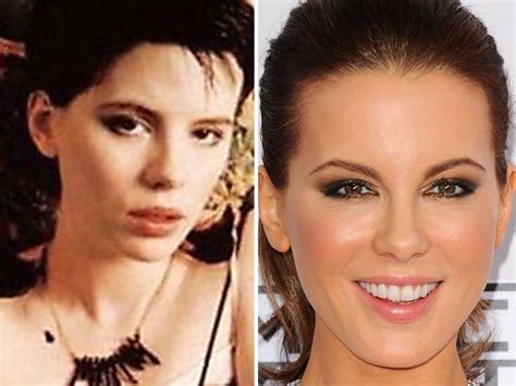 Top 10 Plastic Surgery Transformations at Brent Vangundy blog