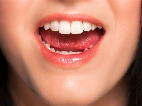 realidades del cuidado de los dientes