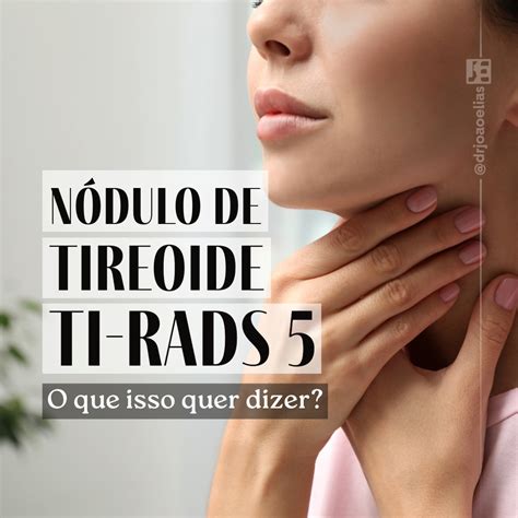 nodulo de tireoide ti rads   ultrassom   isso quer dizer dr