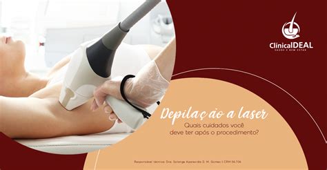 Cuidados Após Depilação A Laser - Depilação a laser: quais cuidados você deve ter após o procedimento ...