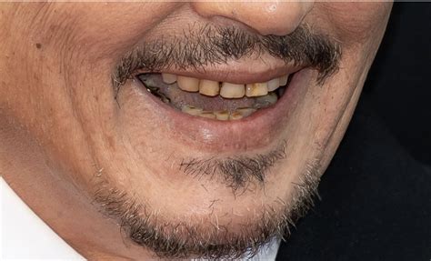Johnny Depp’s teeth visibly rotting, fans react in disgust