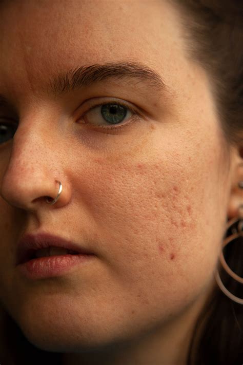 Best Dermatologist Near Me For Skin Rashes