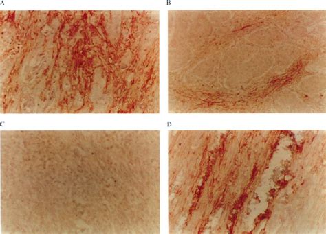 photomicrographs  paraffin embedded tissue sections  invasive
