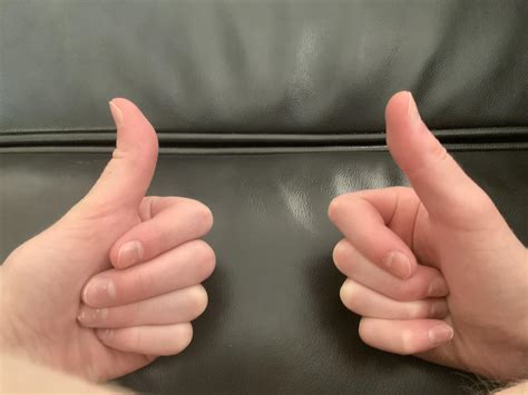 One of my thumbs is bent while the other's straight when I do a thumbs