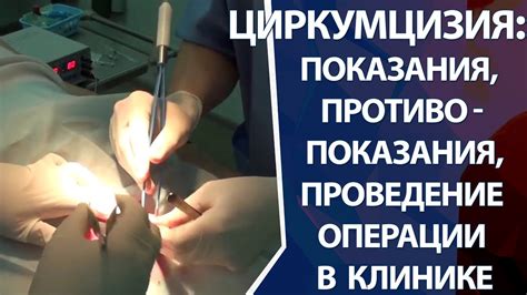 Циркумцизия - YouTube