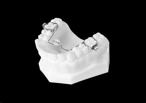 Tongue Bead (Tongue Toy) - Universal Orthodontic Lab