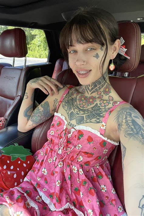 List of All Models Wearing Braces | Braces Lover