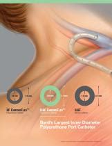 Apheresis Catheter