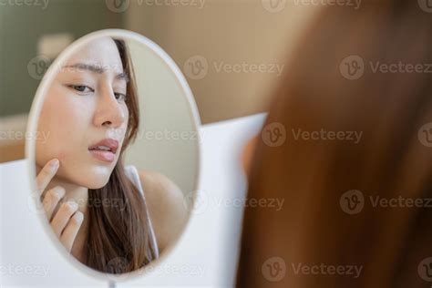Young woman asian are worried about faces Dermatology and allergic to