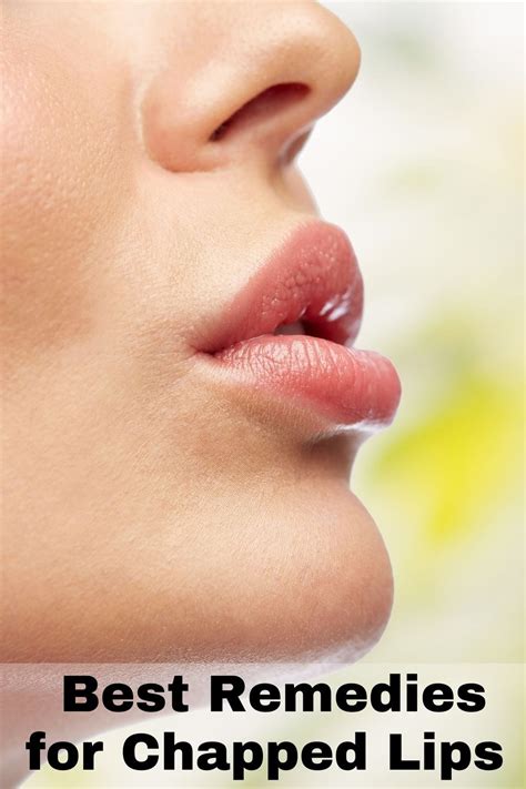 Severely Dry Lips Treatment | Lipstutorial.org