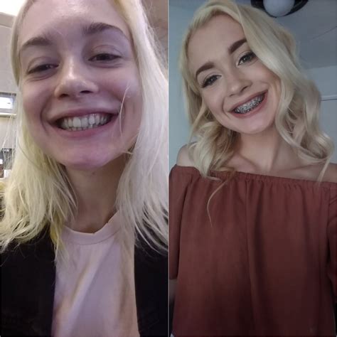 [Anastasia Knight, 18] Anyone looking forward to some Brace-face & Teen
