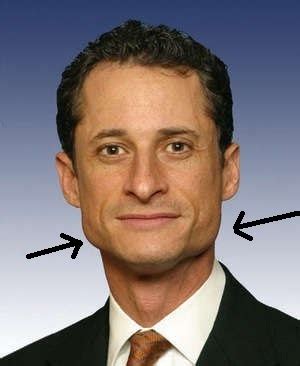 crystal lake dentals hot topics anthony weiner  reveal  bruxer