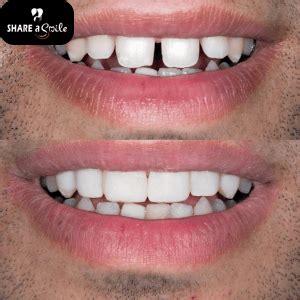 Transform Your Smile with Innovative Smile Designing Solutions